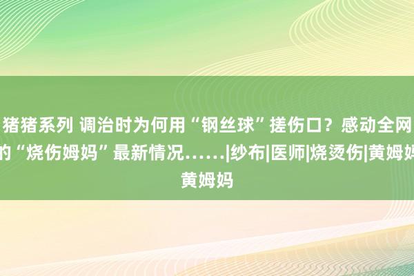 猪猪系列 调治时为何用“钢丝球”搓伤口？感动全网的“烧伤姆妈”最新情况……|纱布|医师|烧烫伤|黄姆妈